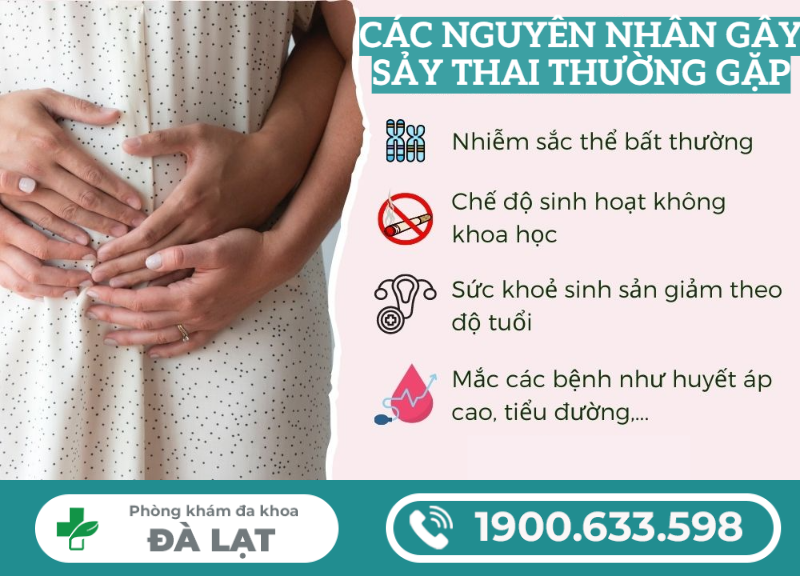 Hình ảnh minh họa